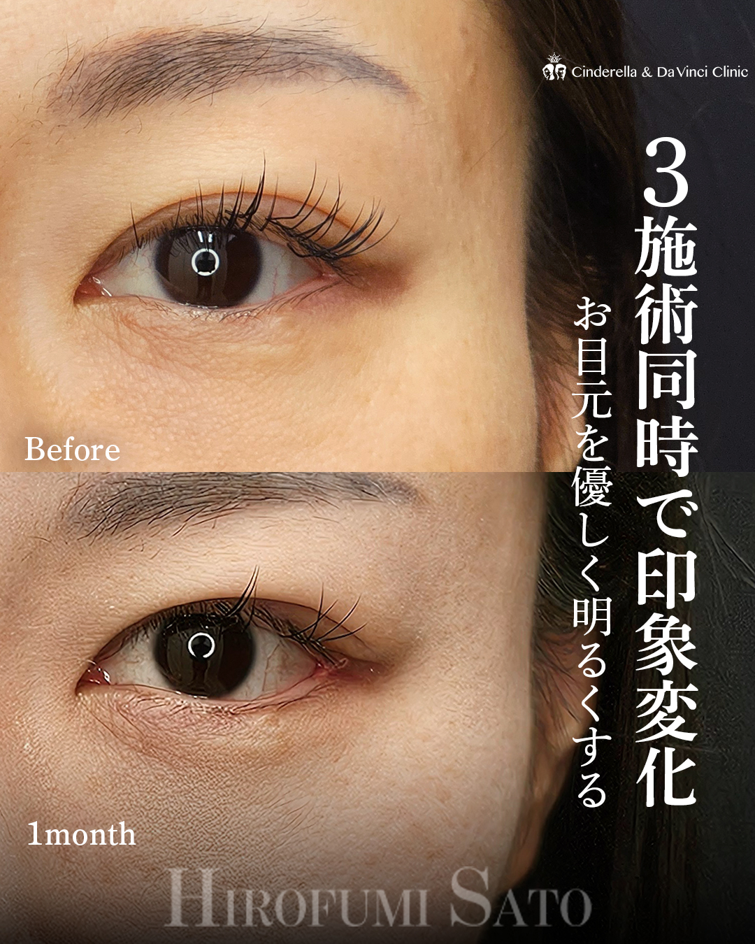 同時施術で変化の画像