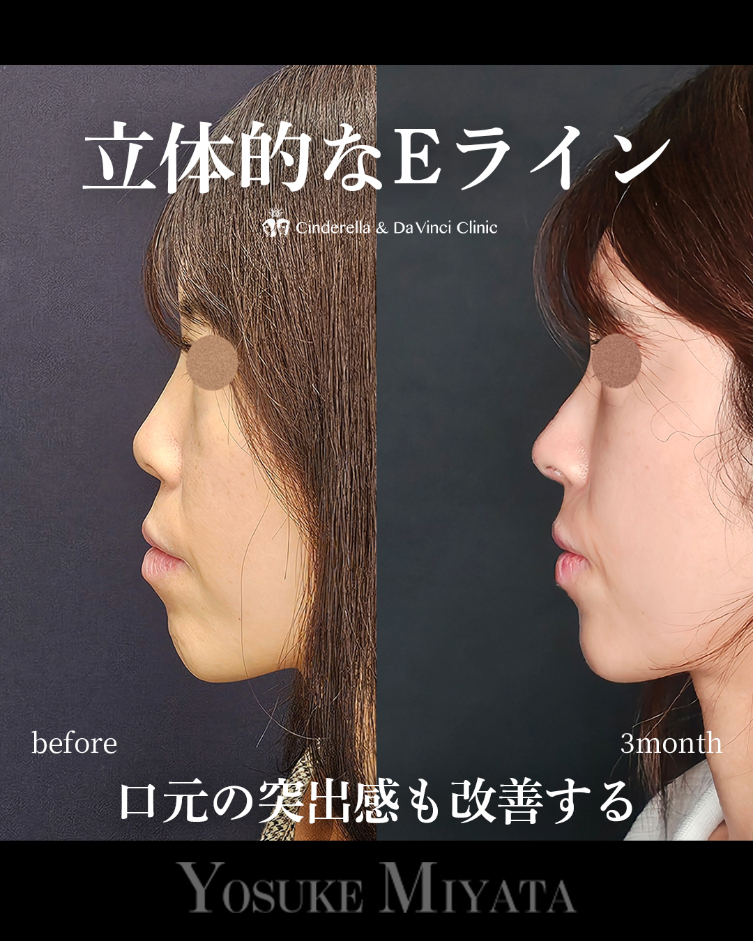 立体的な横顔の画像