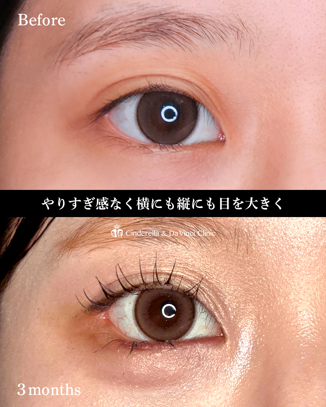 目を大きく見せるの画像