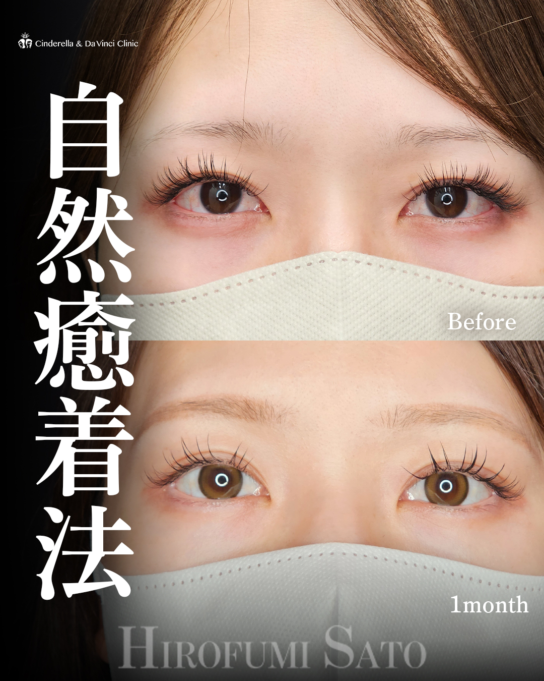 華やかな二重にの画像