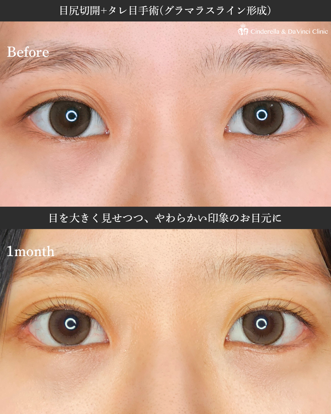 目を大きく見せるの画像