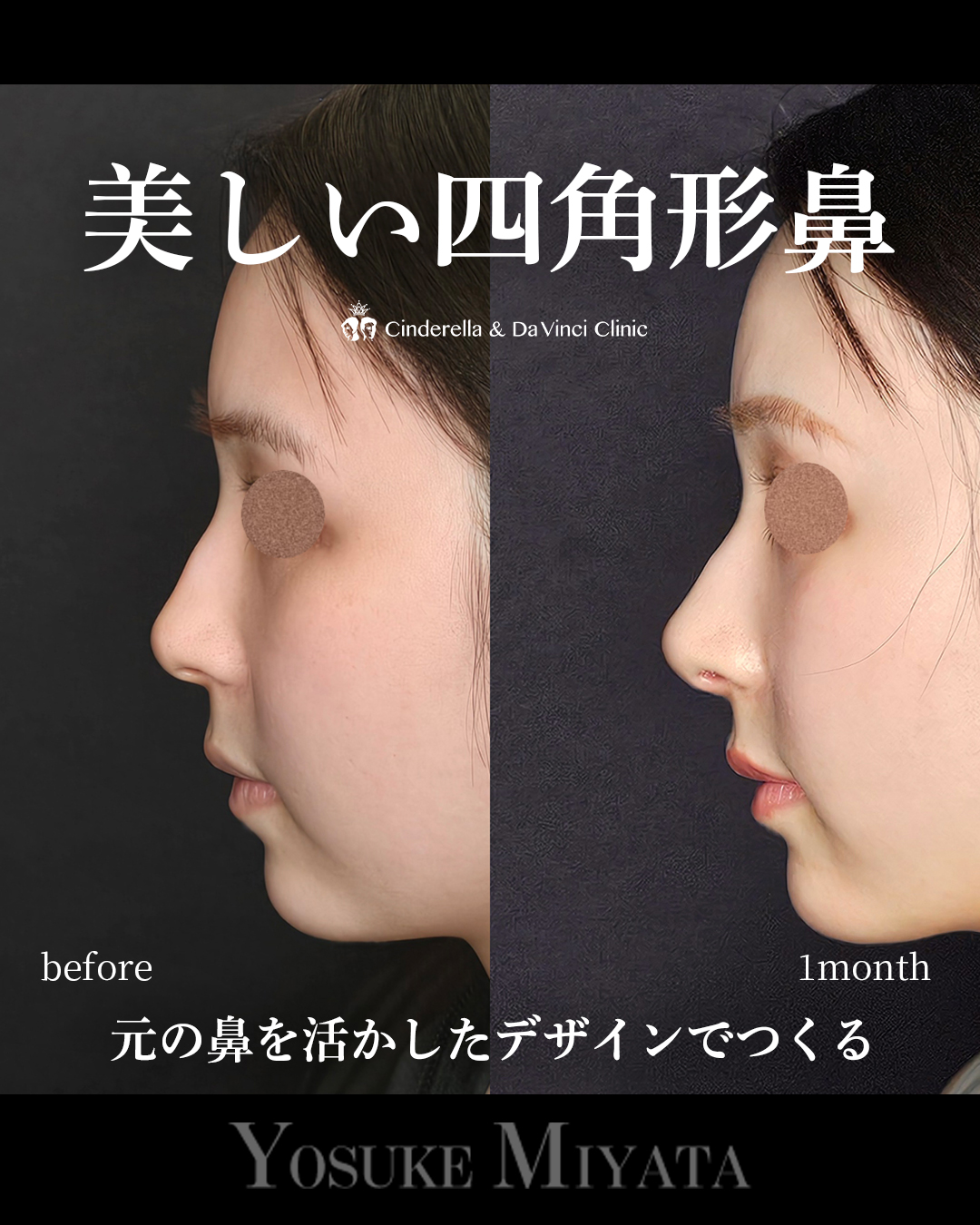 美しい四角形鼻の画像