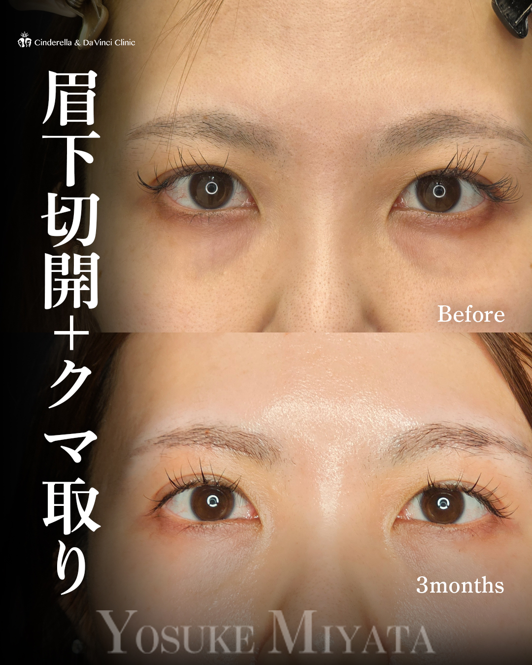 目元スッキリの画像
