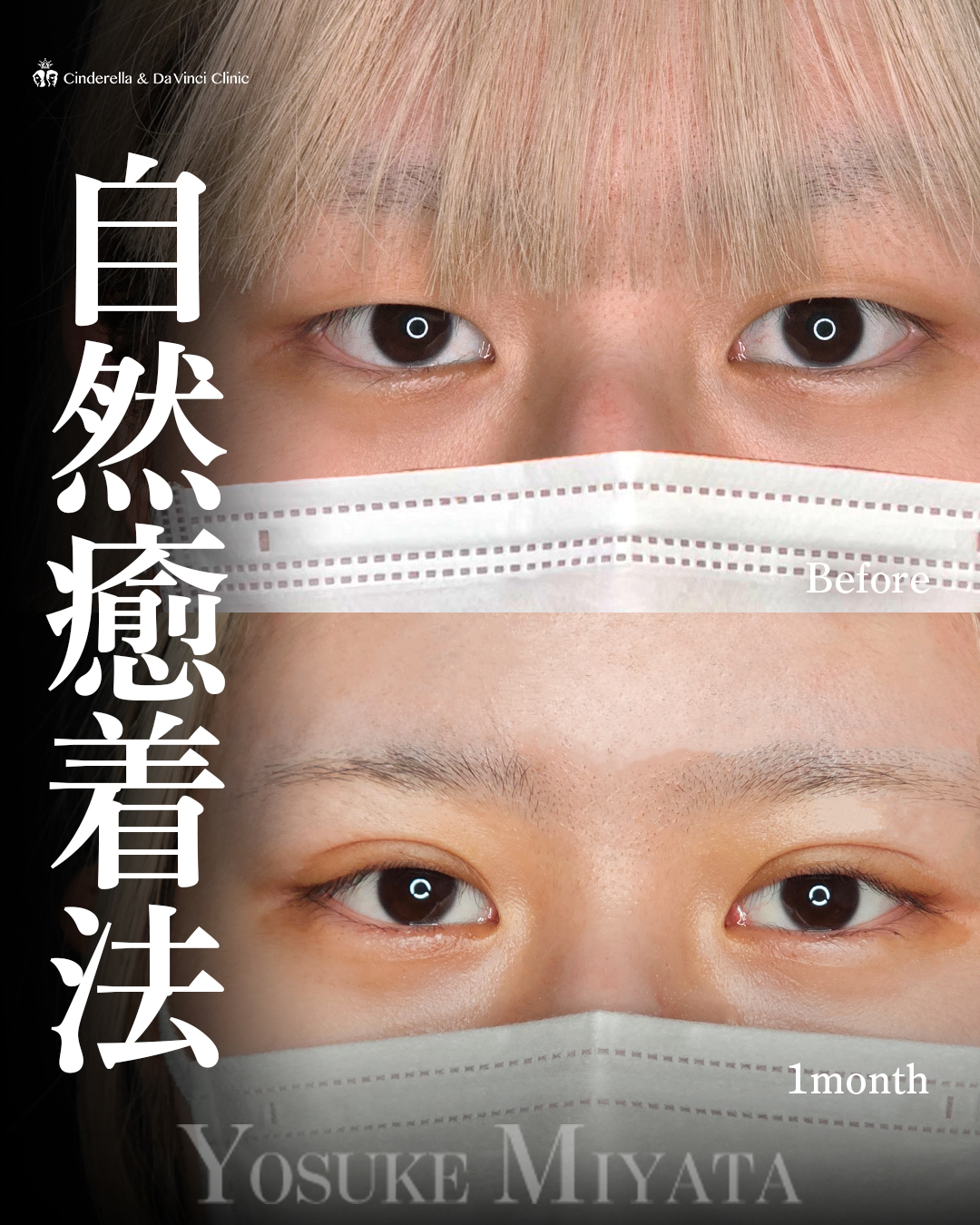 パッチリアイの画像