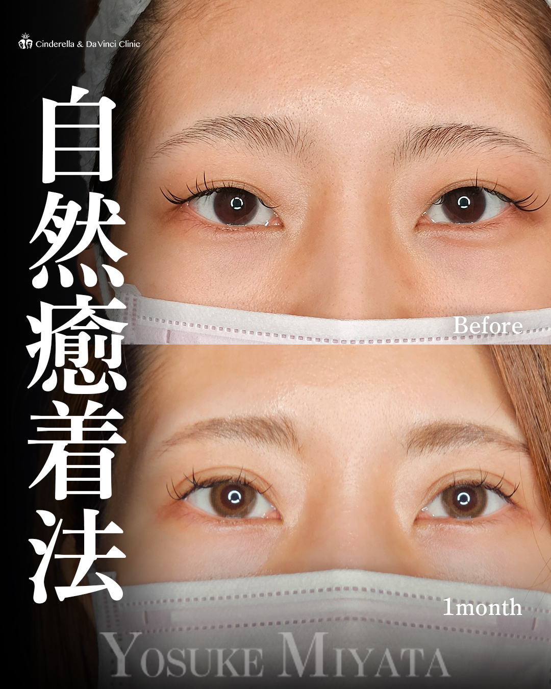 ぱっちり綺麗の画像