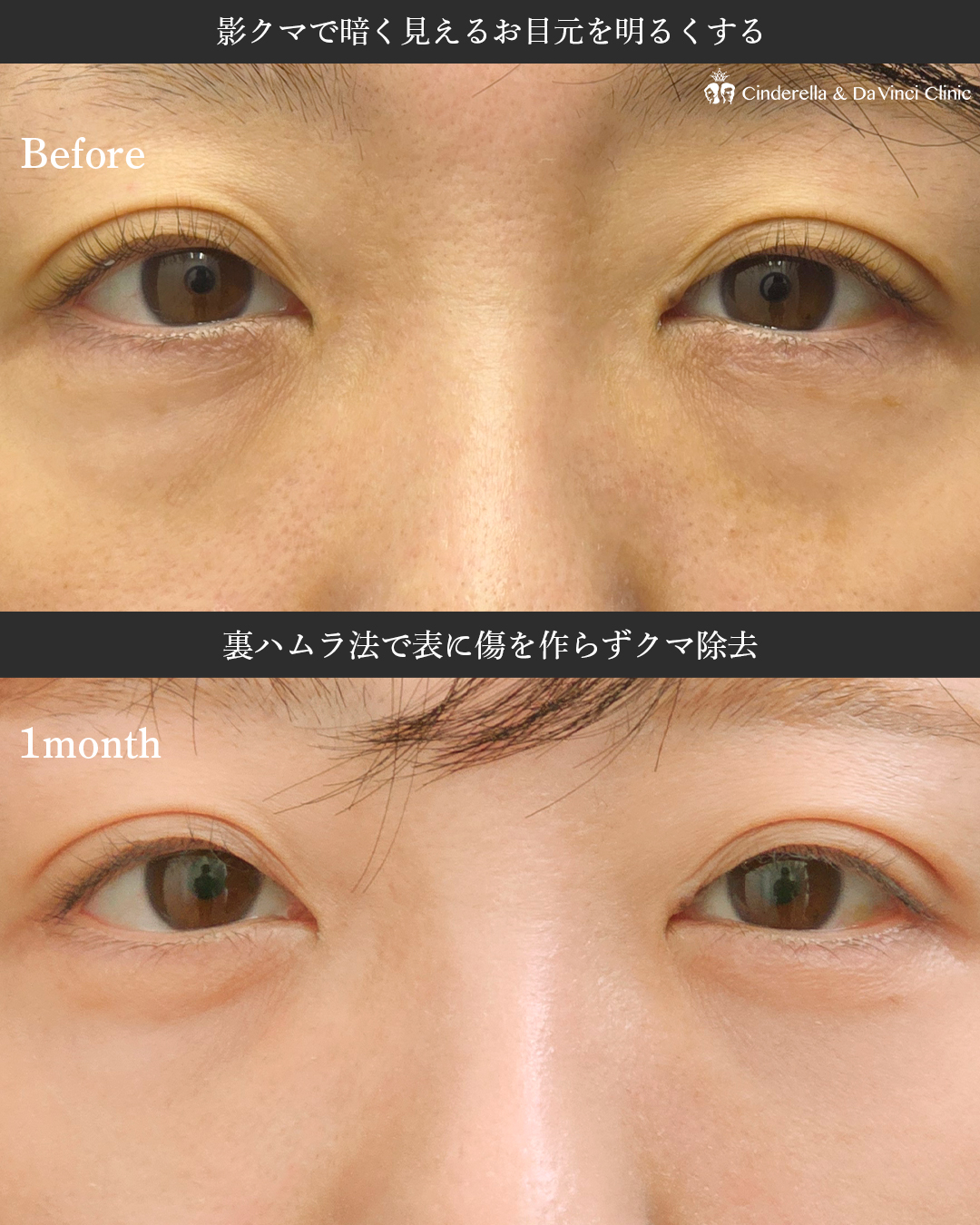 目元の印象明るくの画像