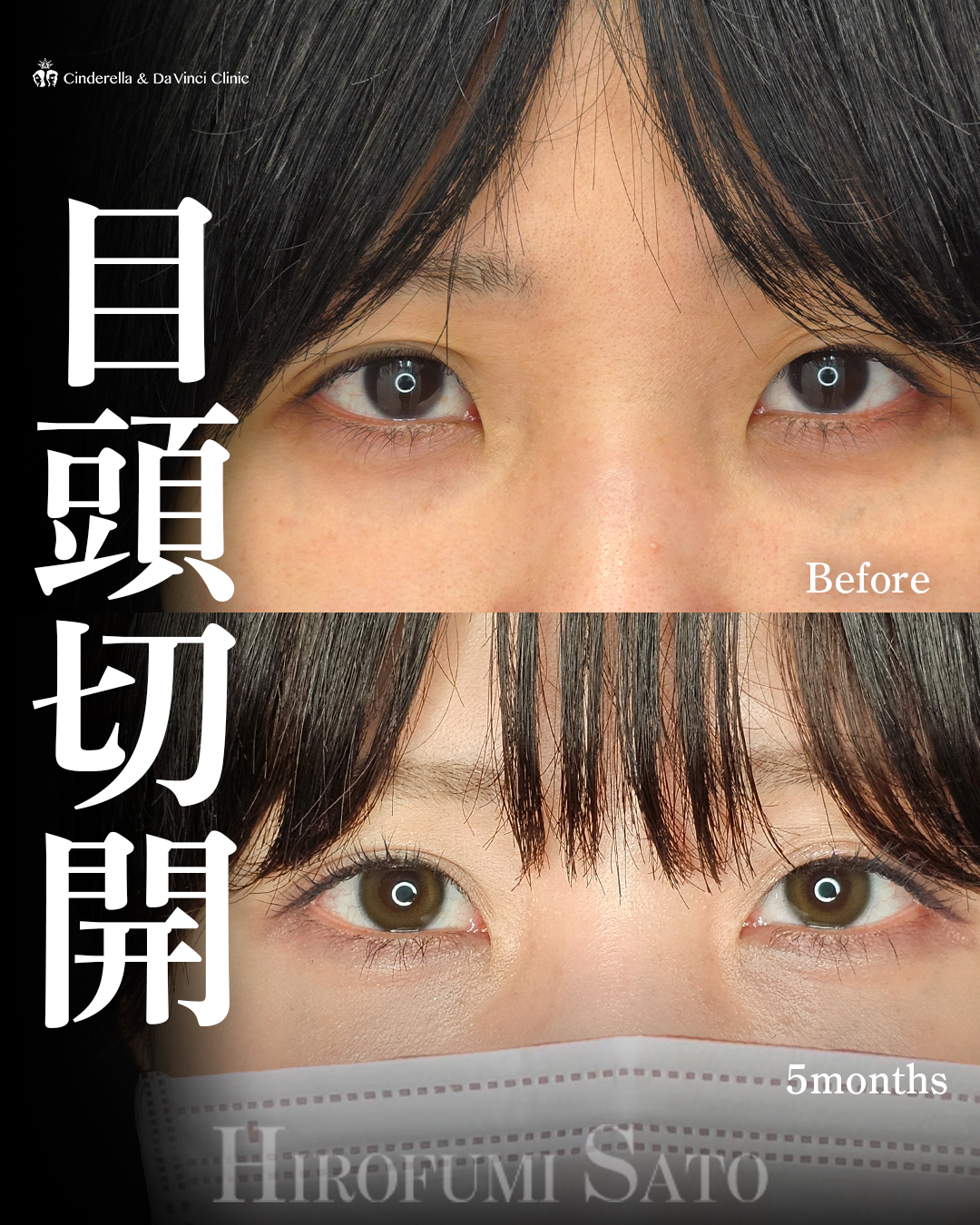 離れ目改善の画像