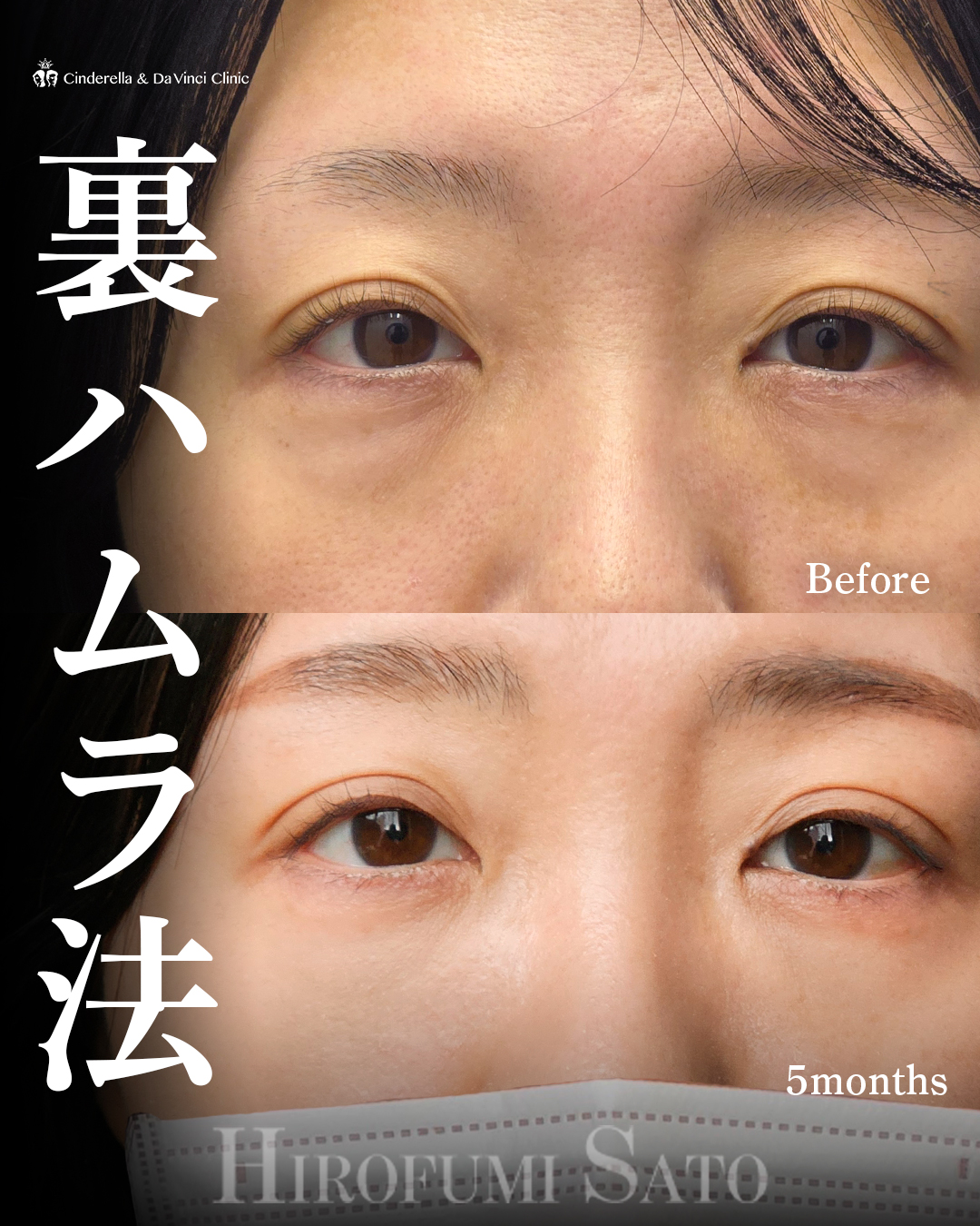 目元の印象明るくの画像