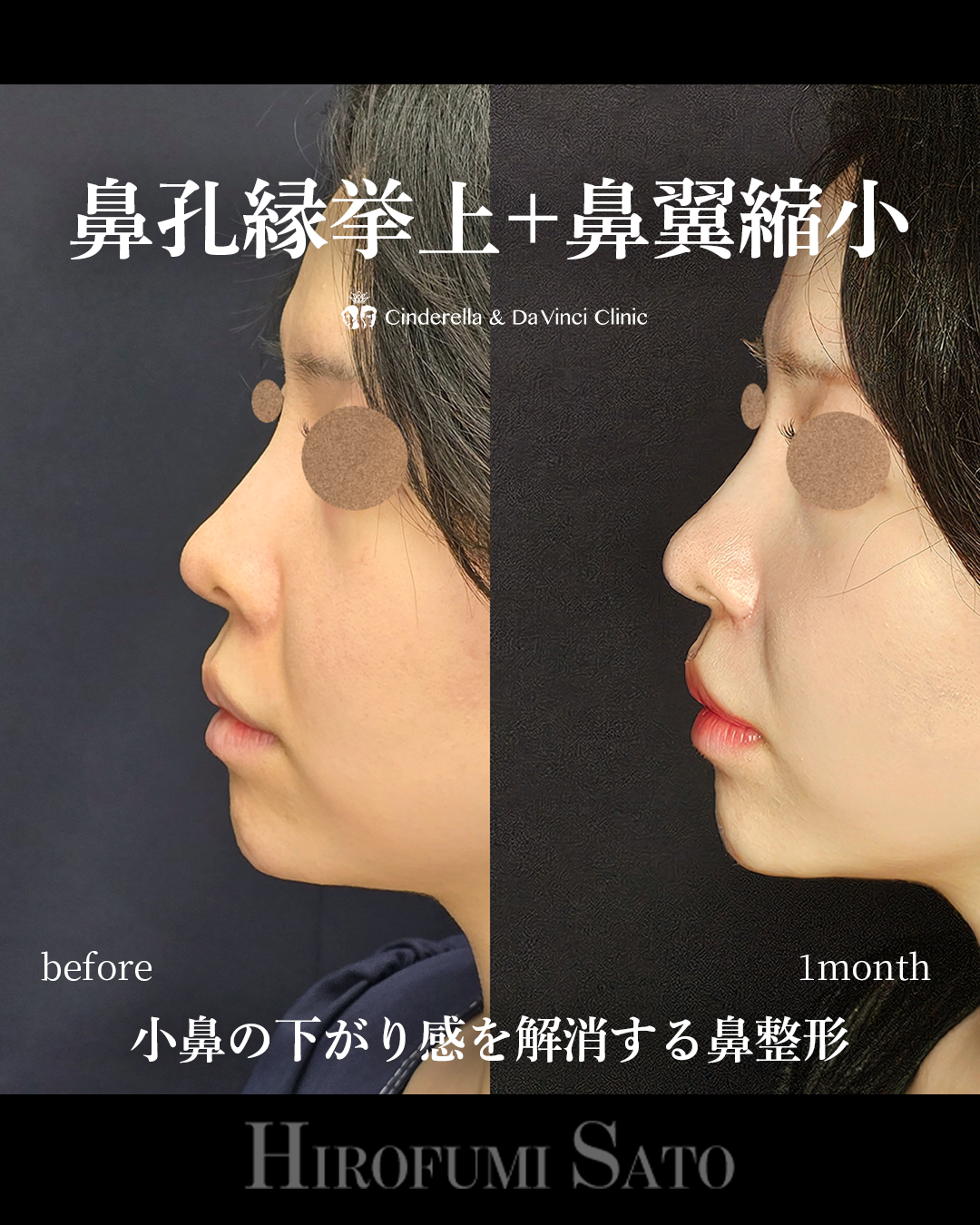 鼻の見え方を変えるの画像