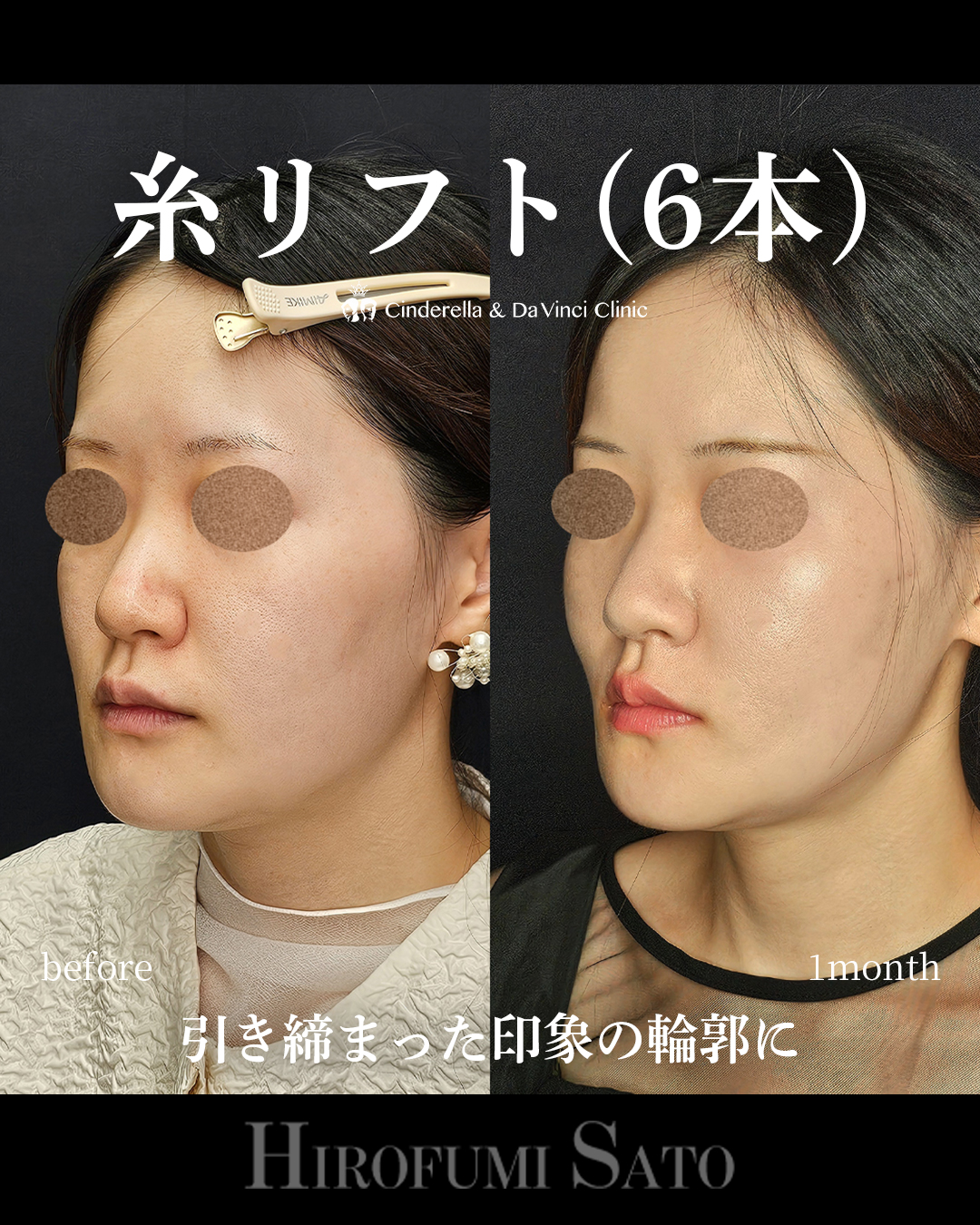 引き締まった輪郭の画像