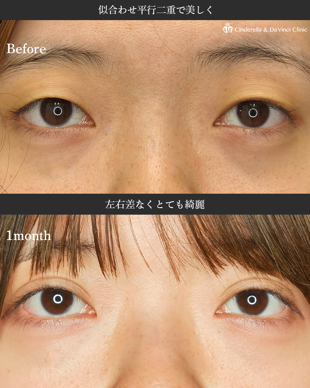 平行二重で美しくの画像