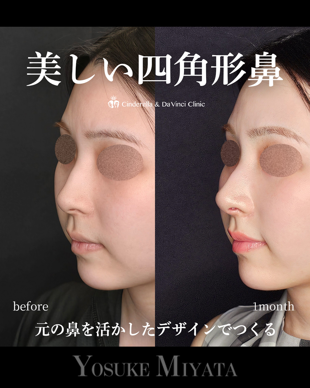 美しい四角形鼻の画像