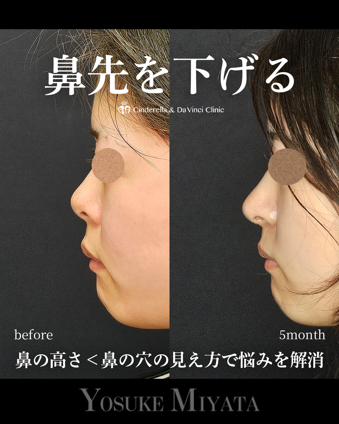 鼻先を下げるの画像