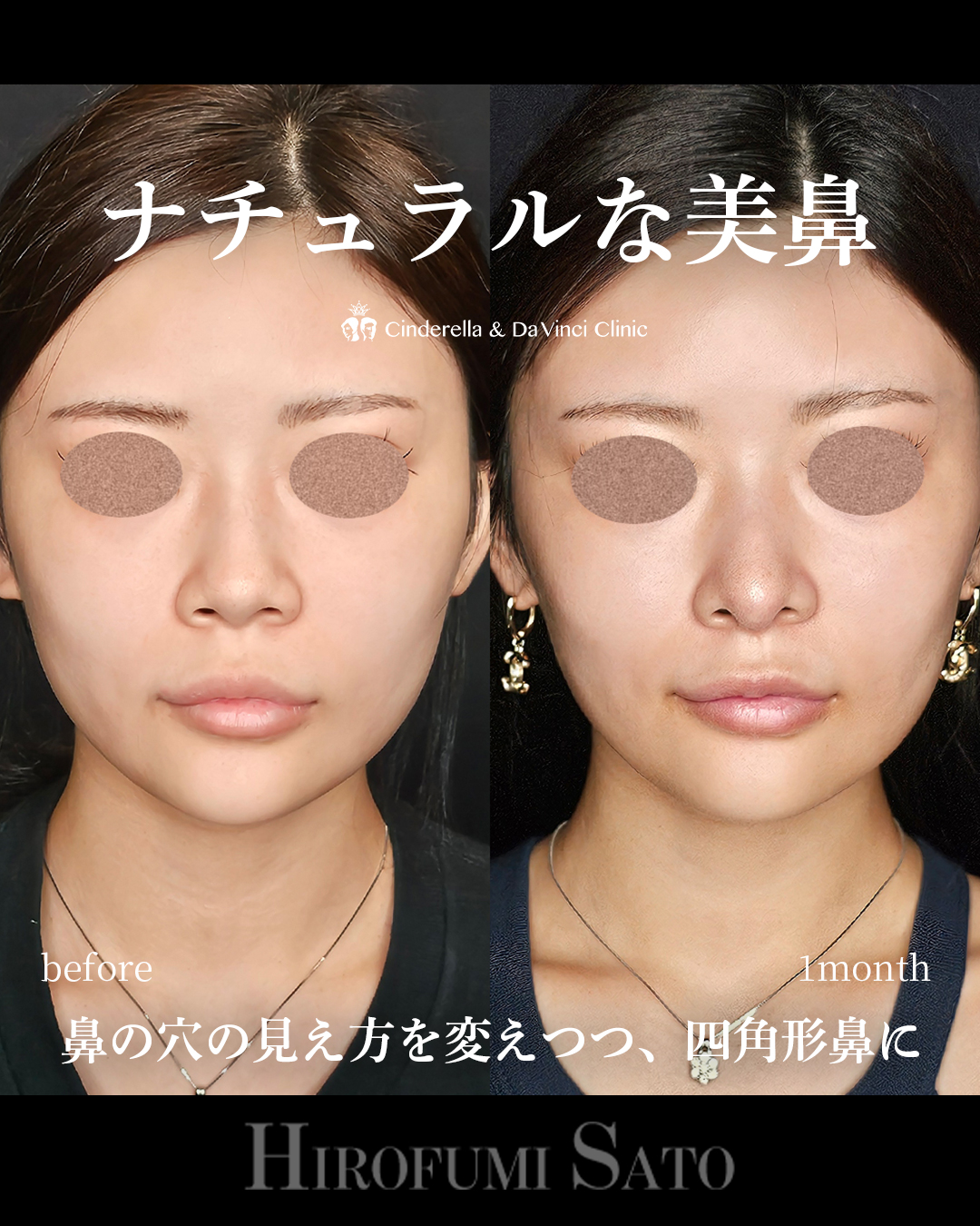 ナチュラルな美鼻の画像