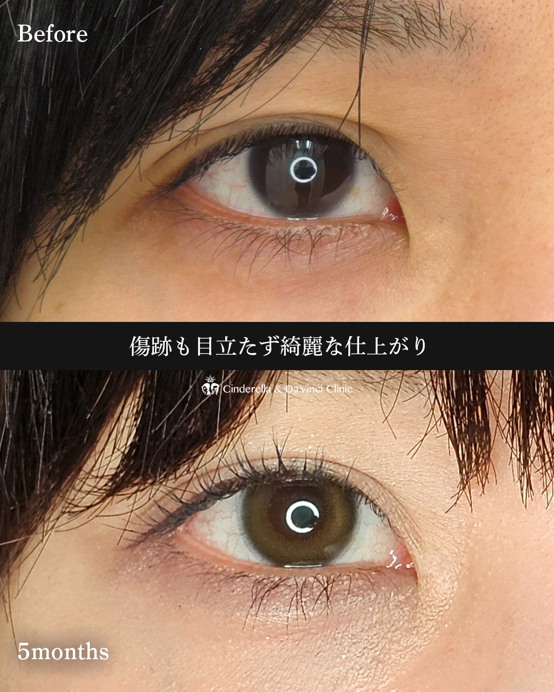 離れ目改善の画像