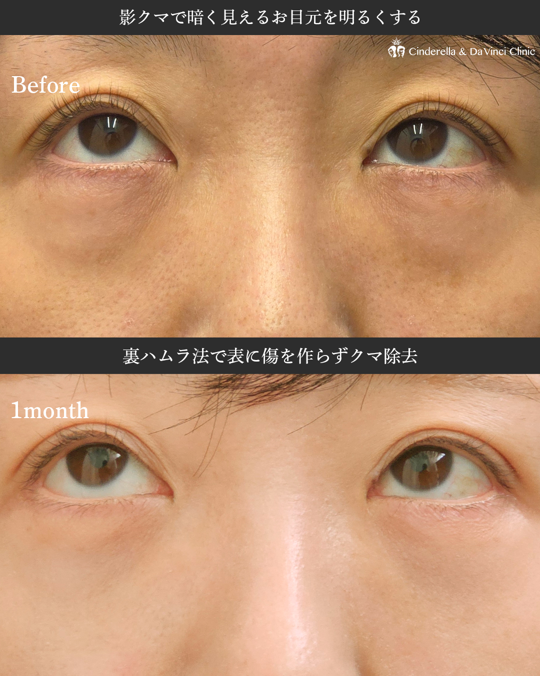 目元の印象明るくの画像