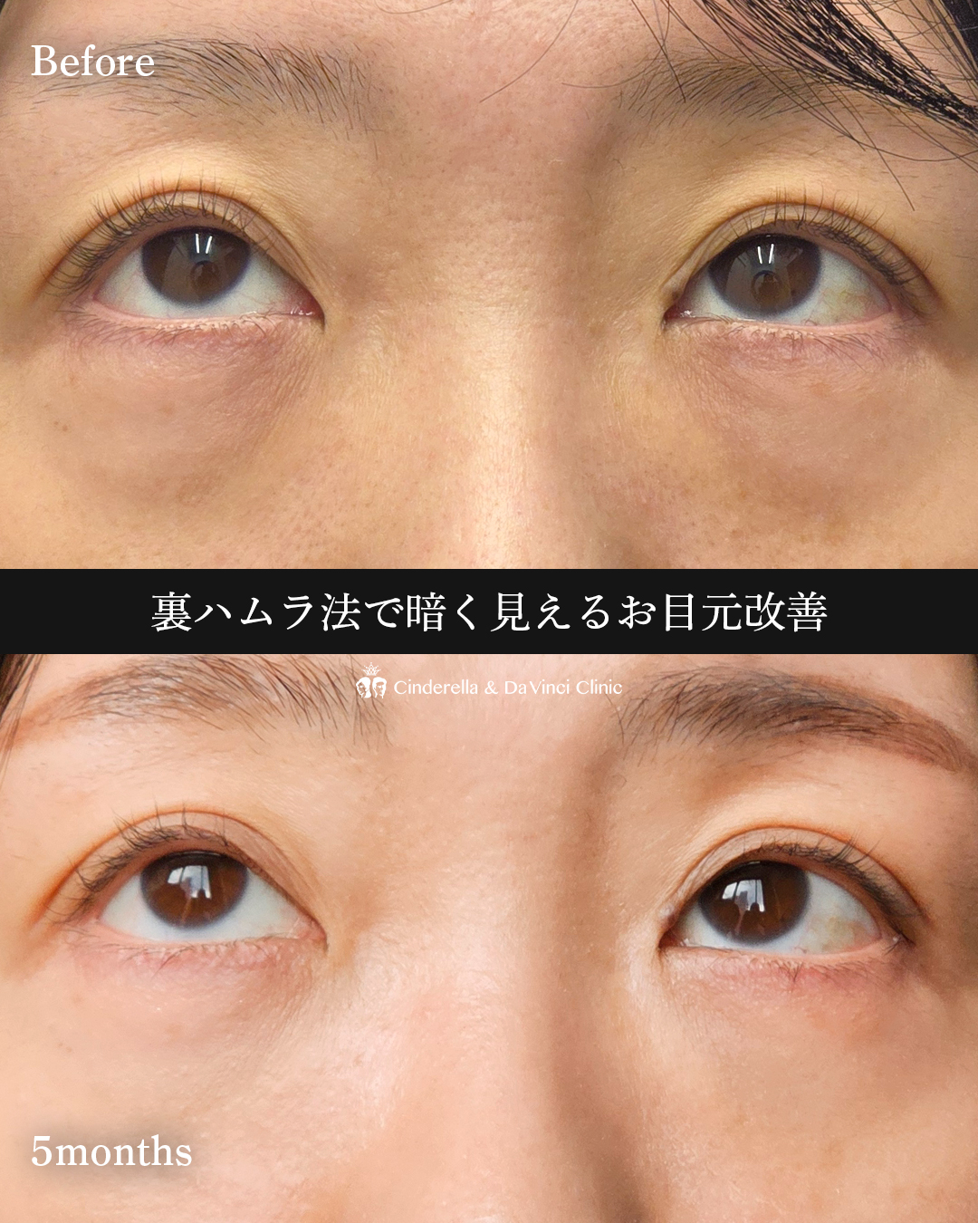 目元の印象明るくの画像