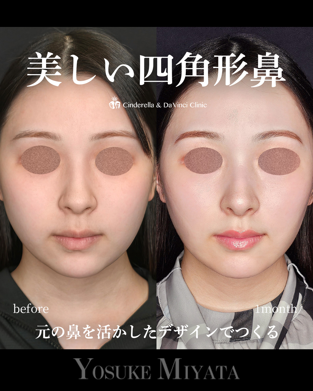 美しい四角形鼻の画像