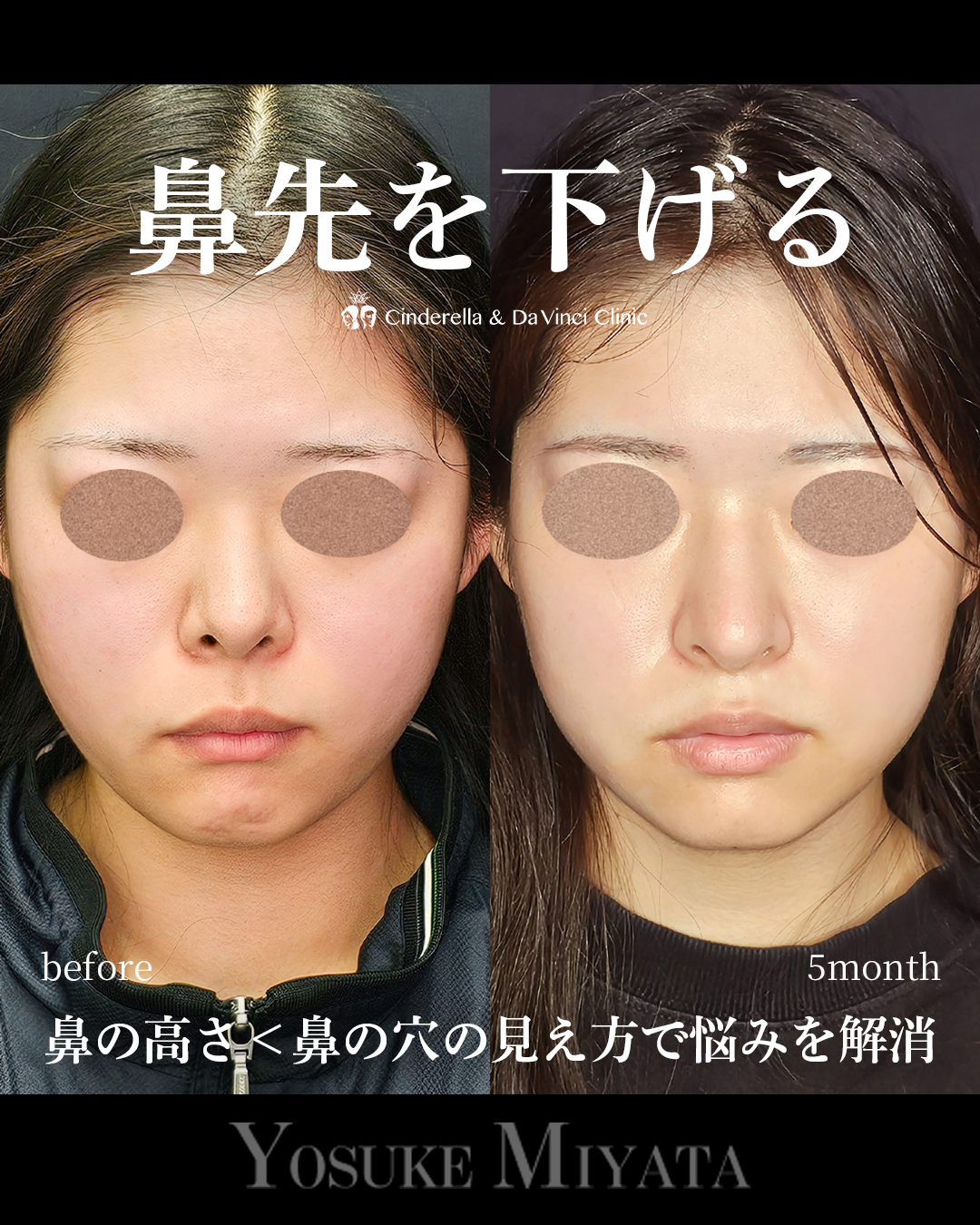 鼻先を下げるの画像