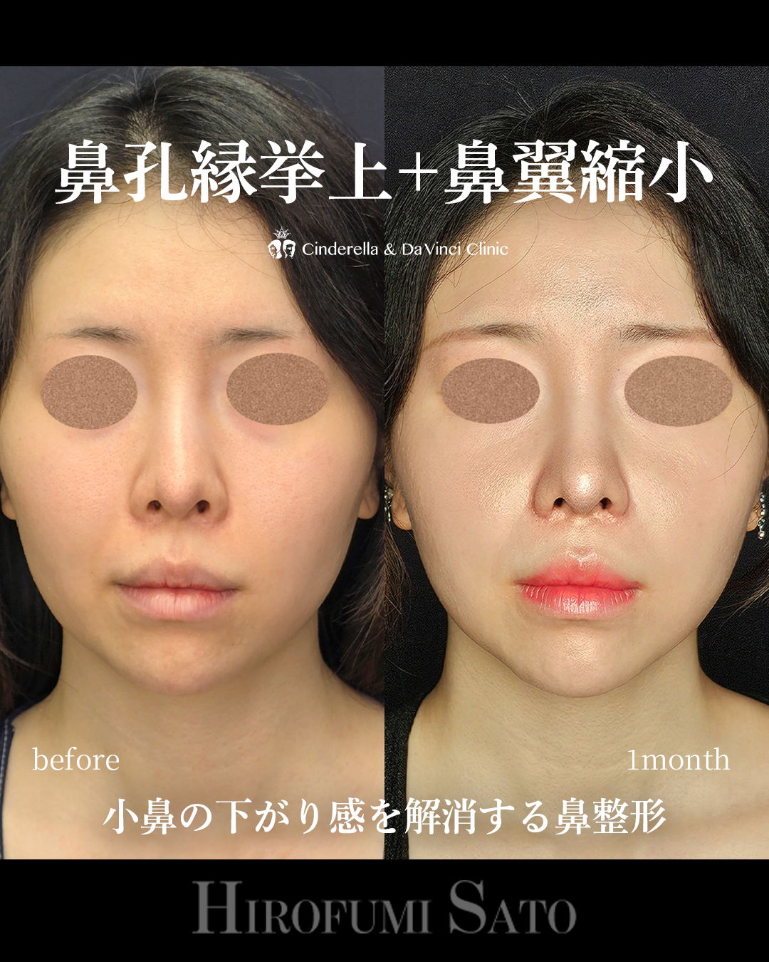 鼻の見え方を変えるの画像