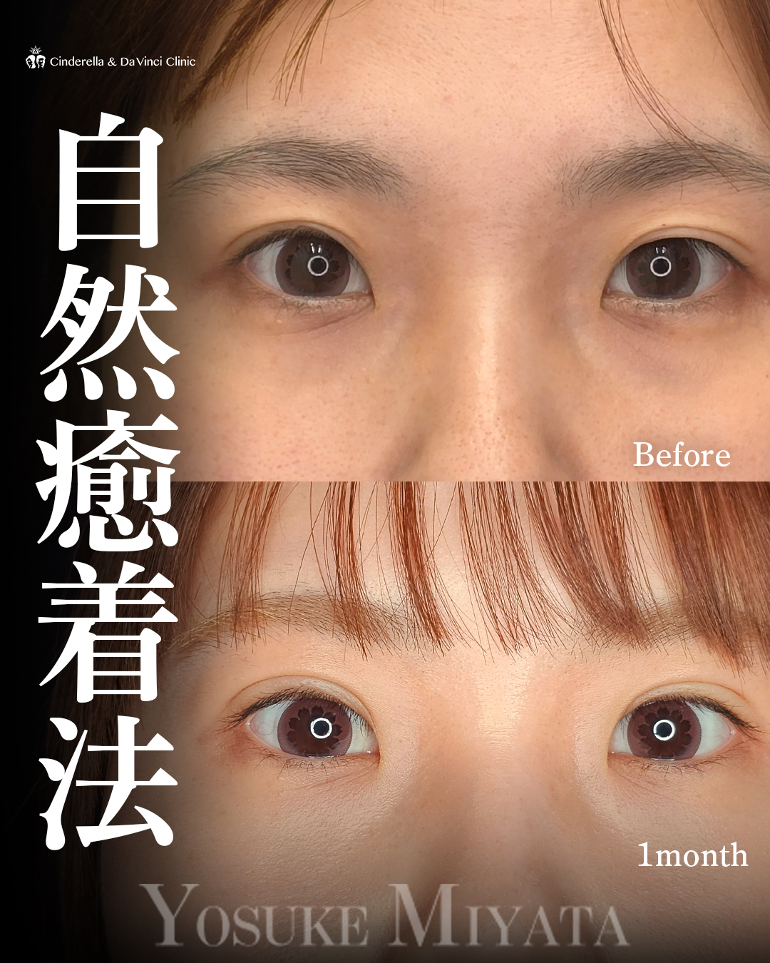 パッチリお目元の画像