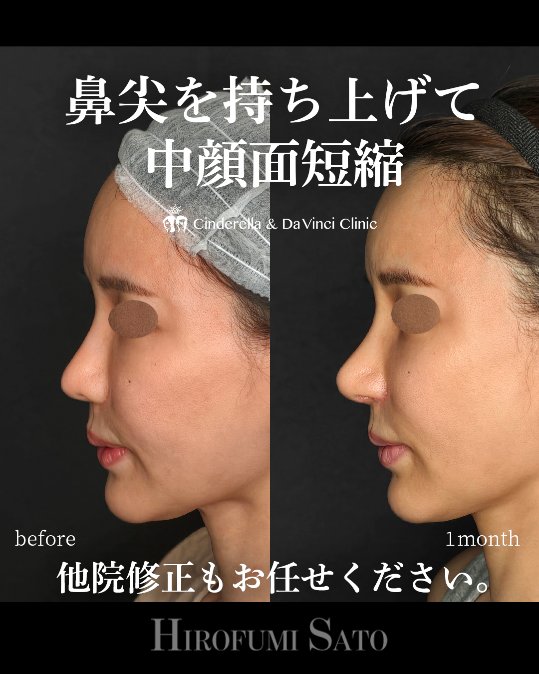 鼻先を持ち上げるの画像