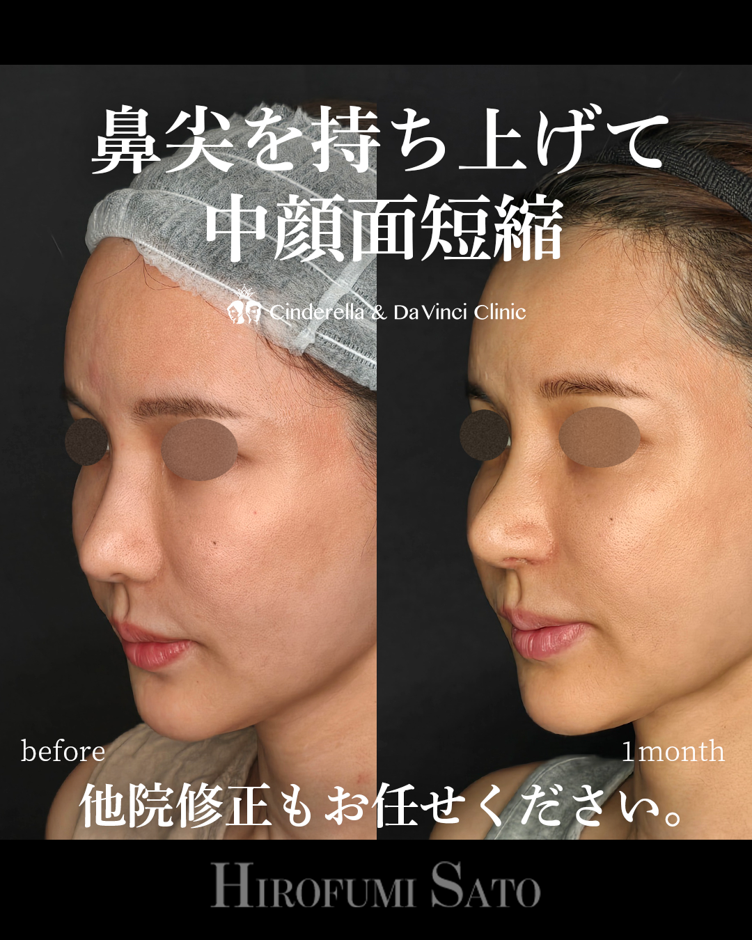 鼻先を持ち上げるの画像