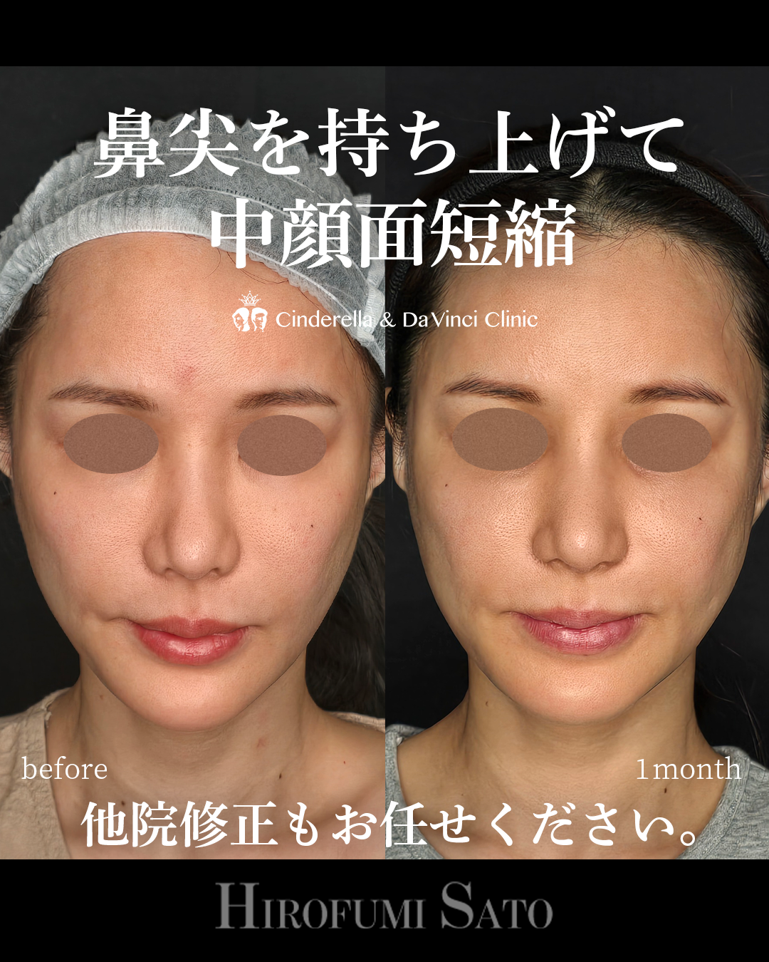 鼻先を持ち上げるの画像