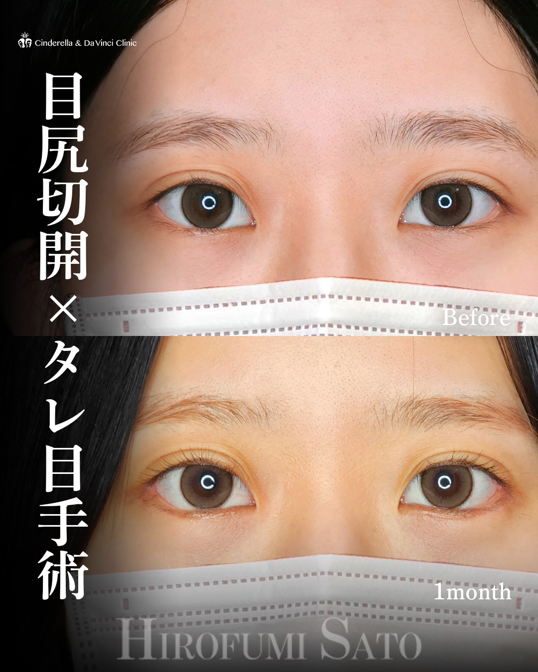 目を大きく見せるの画像