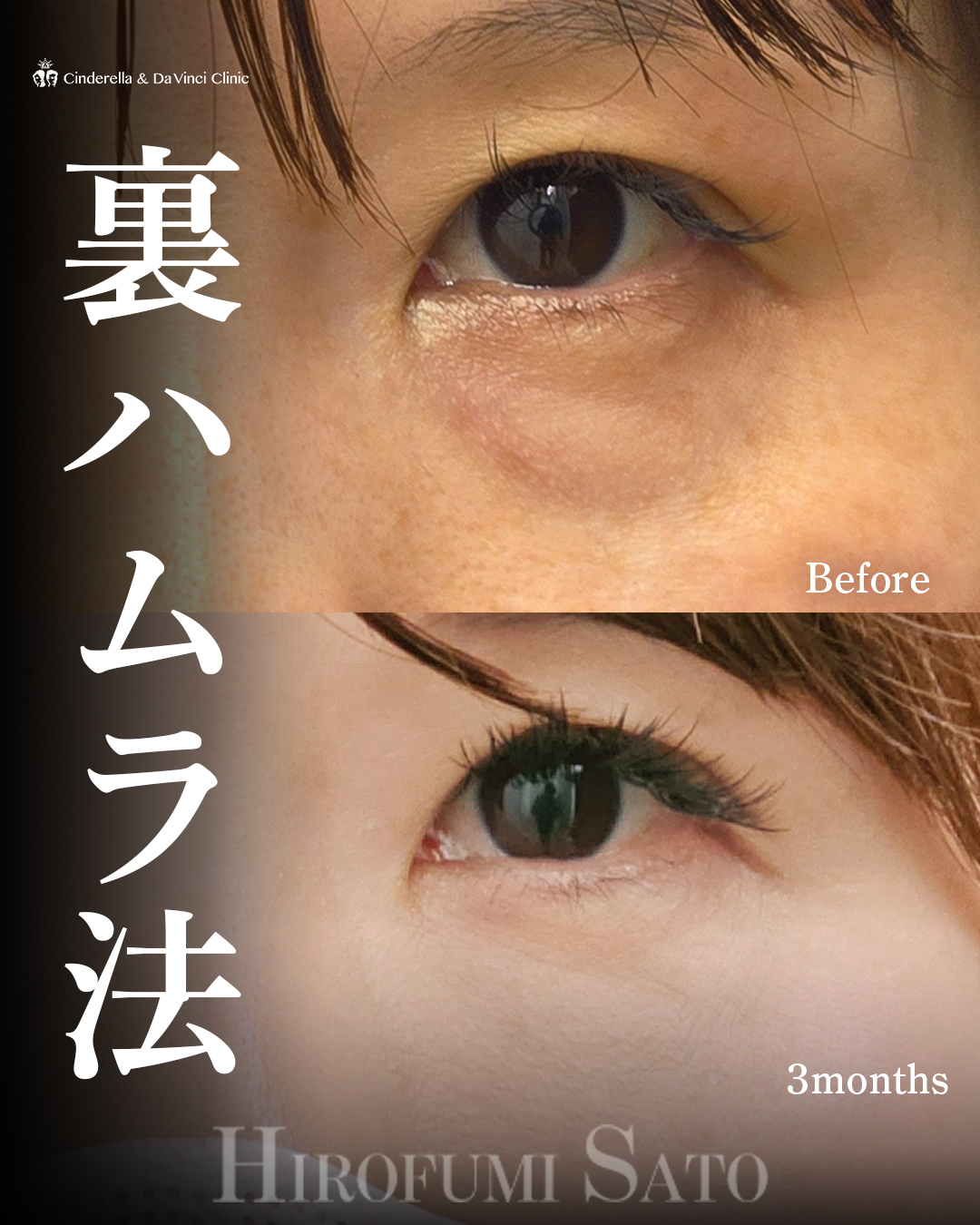 クマ取りで-10歳の画像