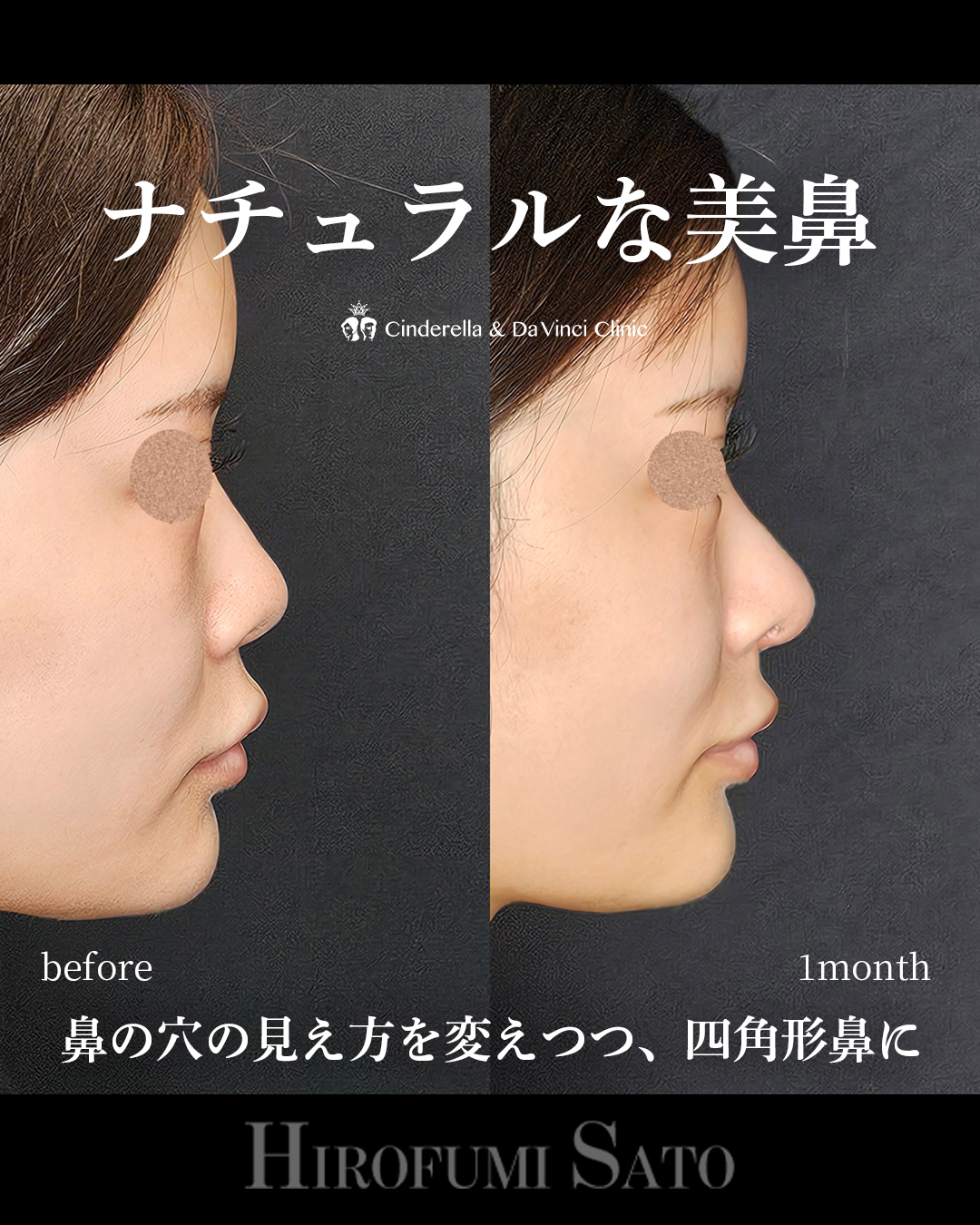 ナチュラルな美鼻の画像