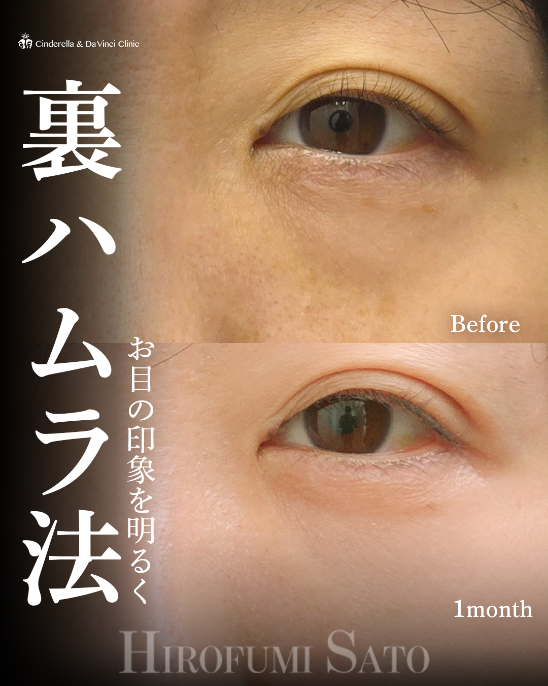 目元の印象明るくの画像