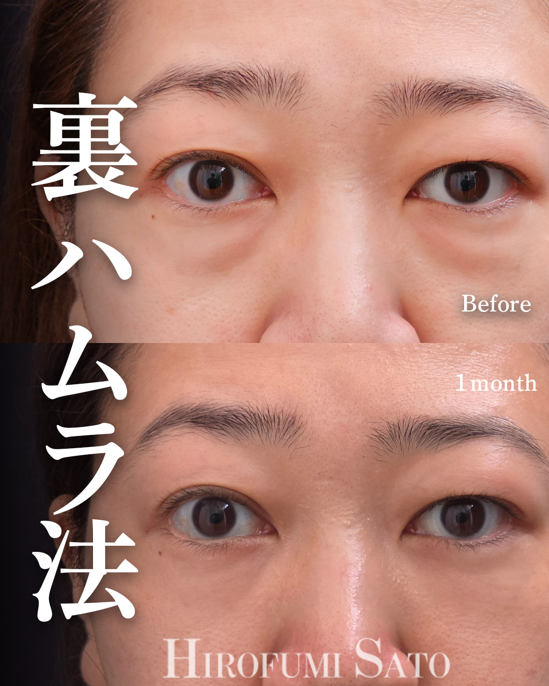 目の下の色ムラ改善の画像
