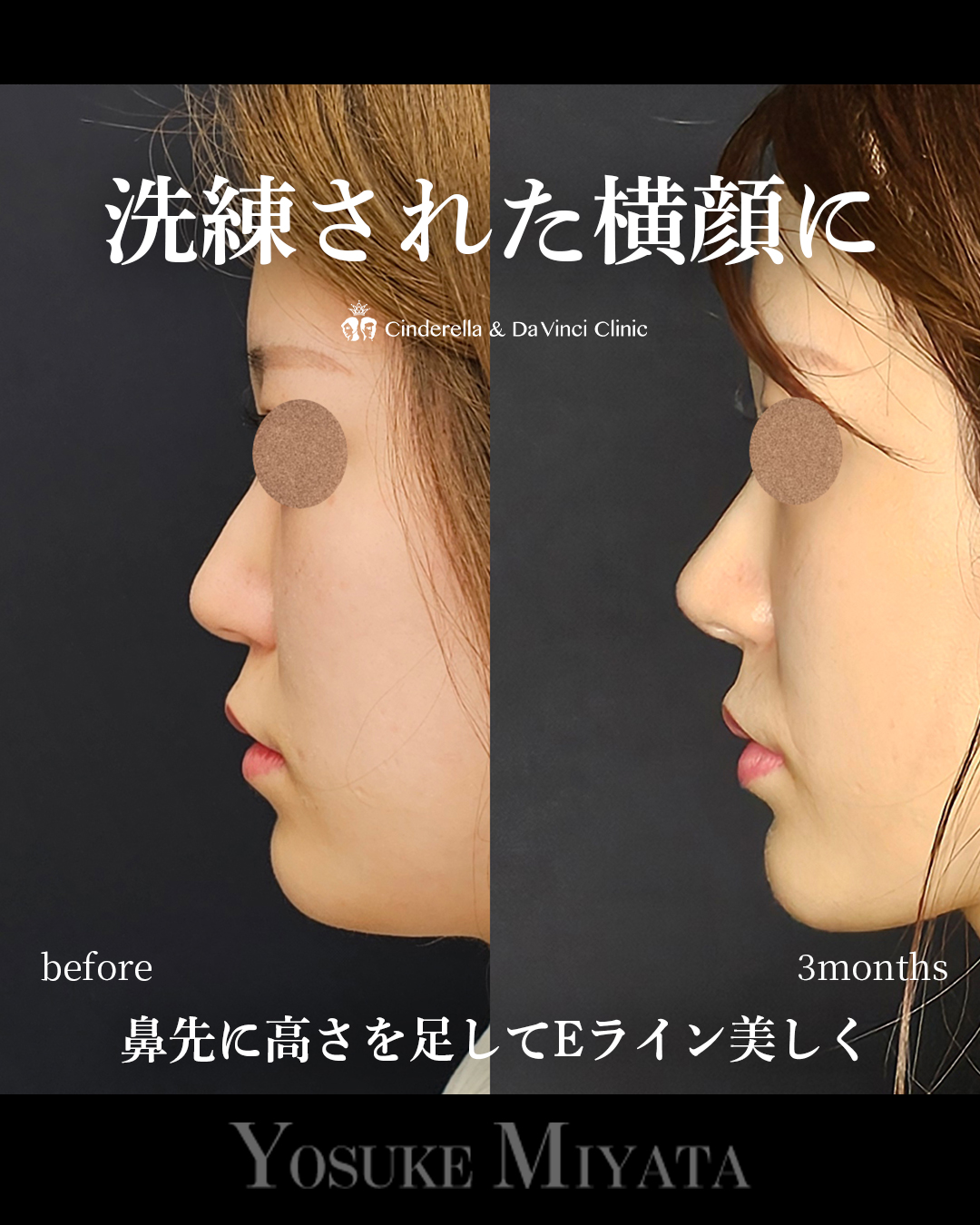 洗練された鼻にの画像
