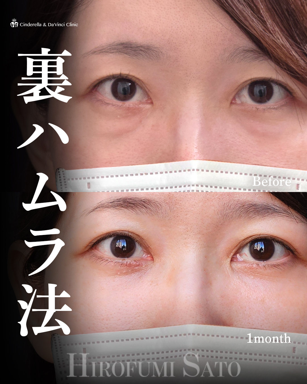 疲れ顔改善の画像