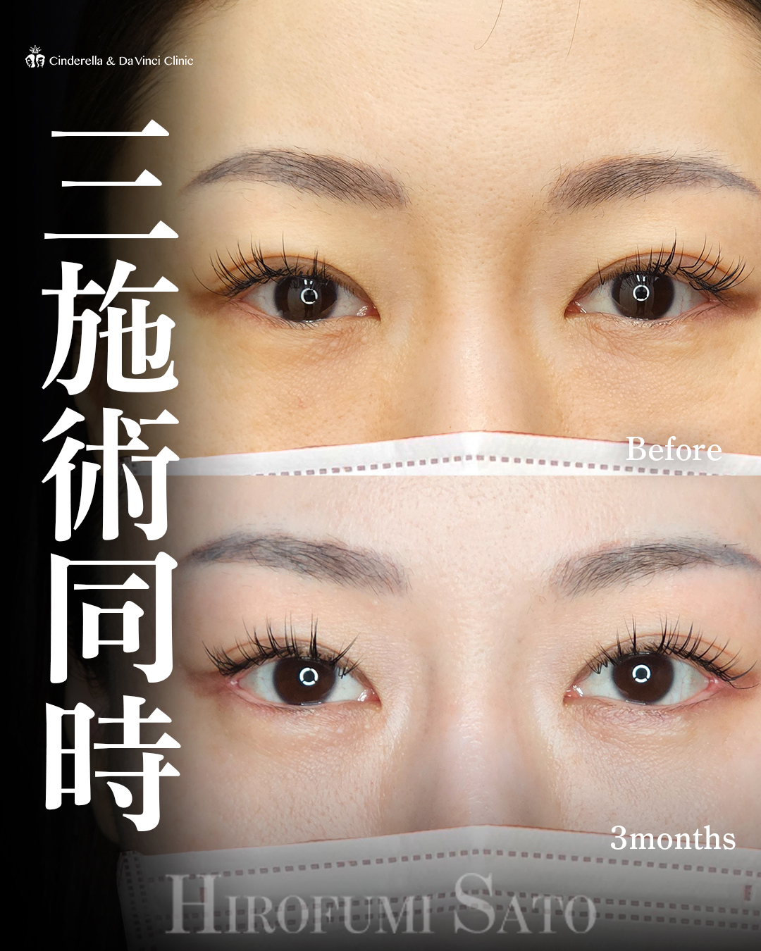 同時施術で変化の画像