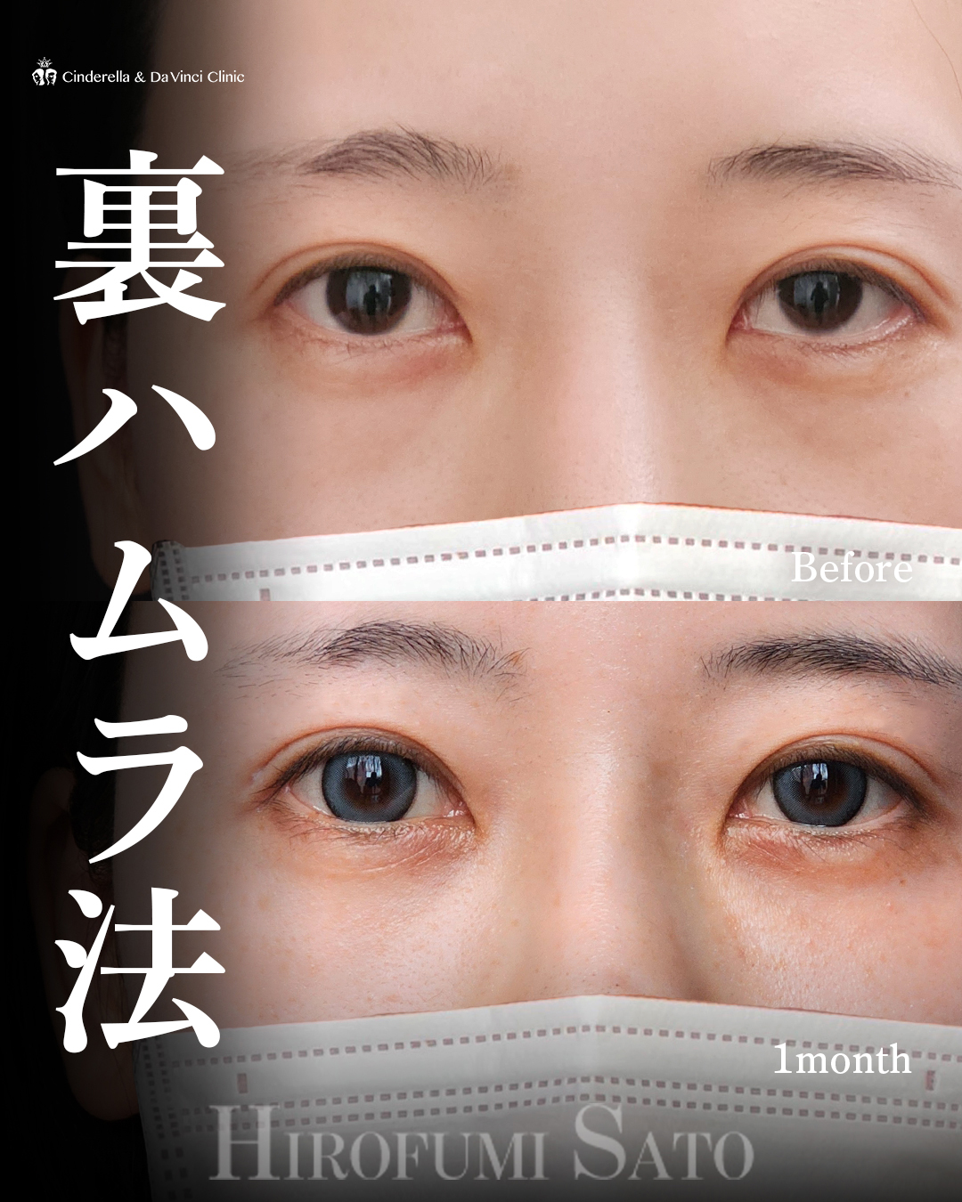 目元すっきりの画像