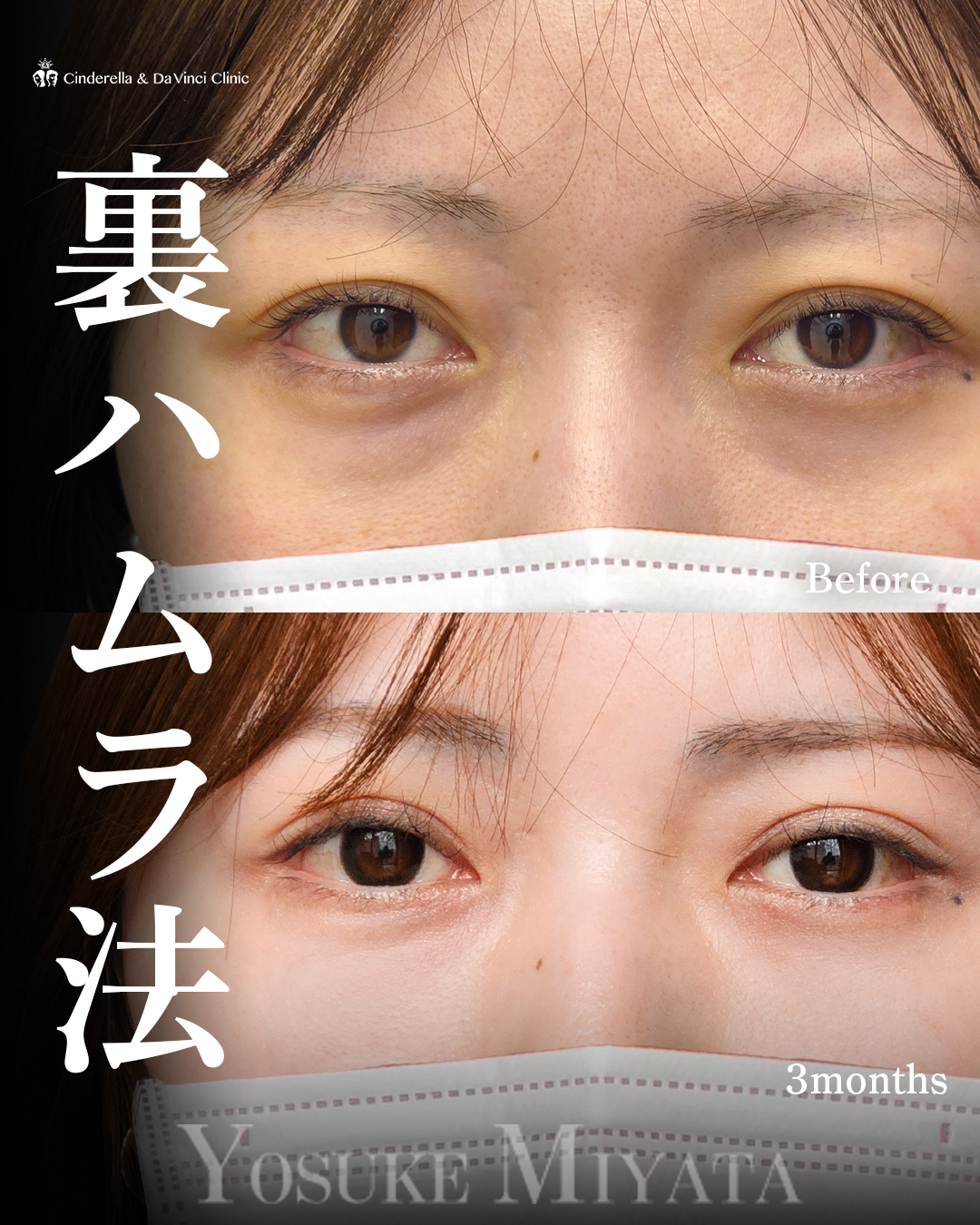 クマとさようならの画像