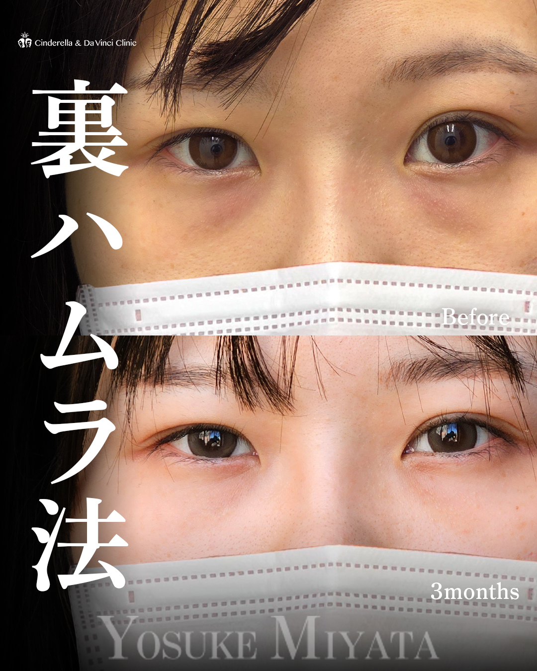 疲れ見え解消の画像