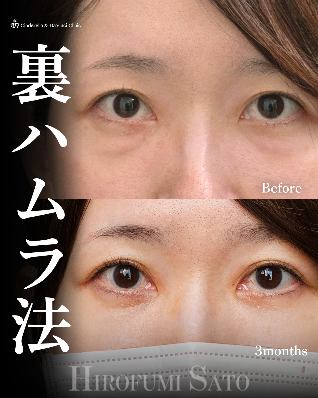 疲れ顔改善の画像