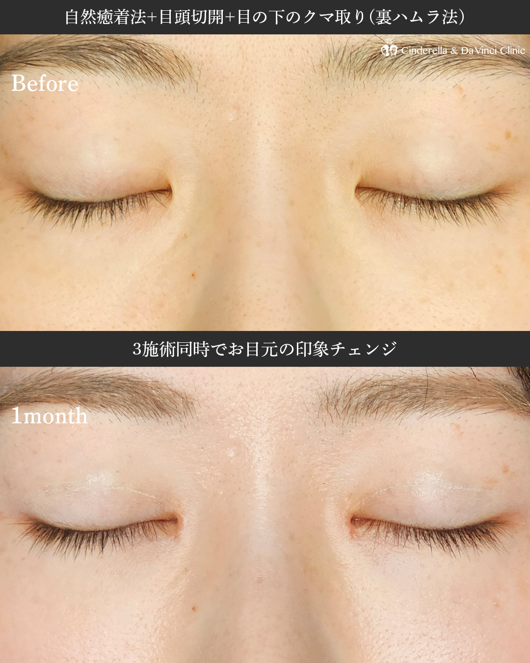 三施術同時の画像