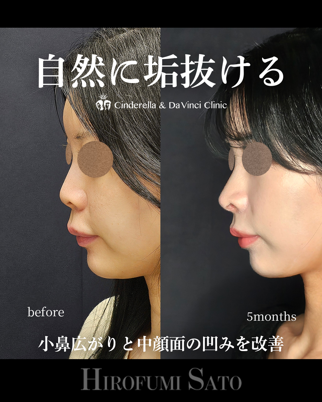 自然に垢抜けの画像