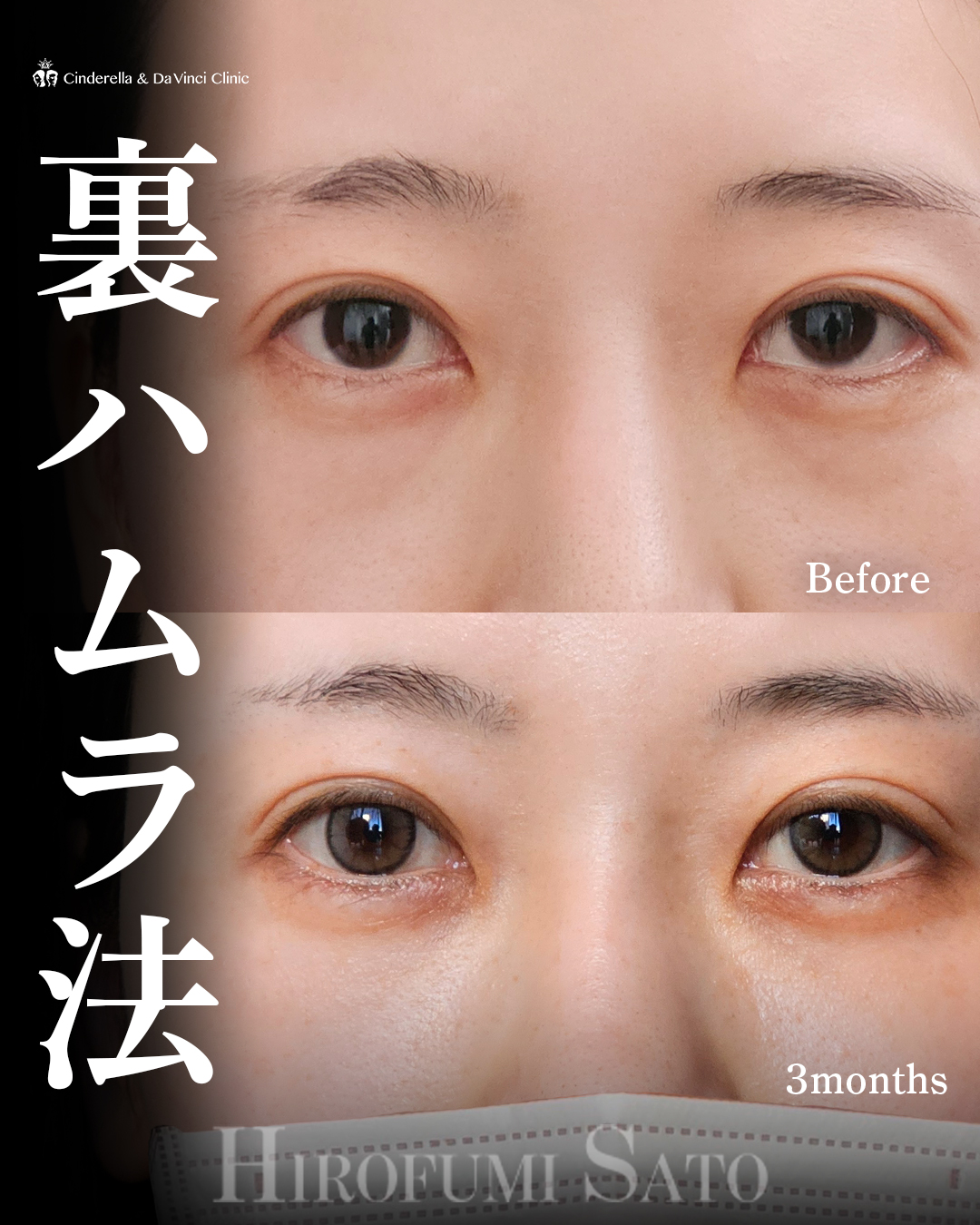 目元すっきりの画像