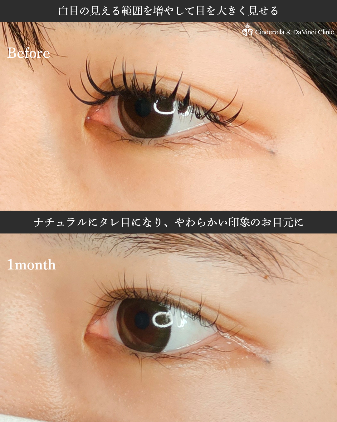 目を大きくするの画像