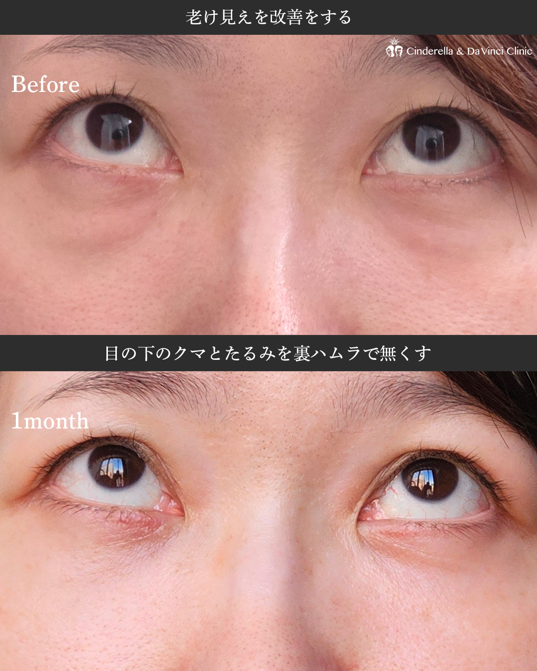疲れ顔改善の画像