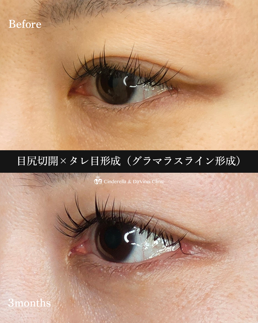 同時施術で変化の画像