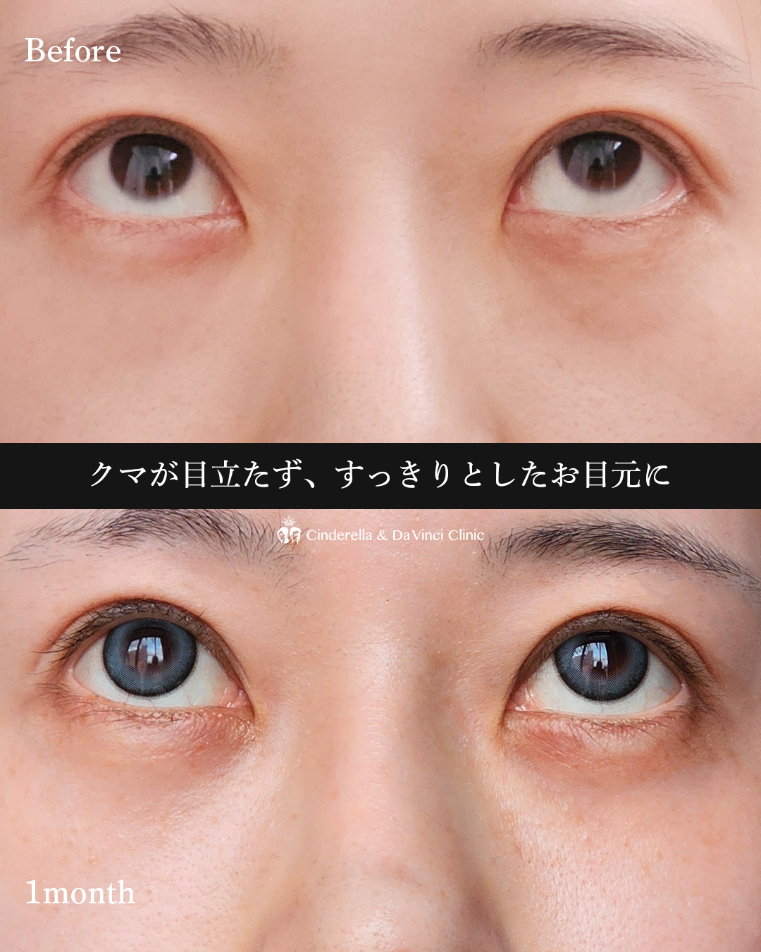 目元すっきりの画像