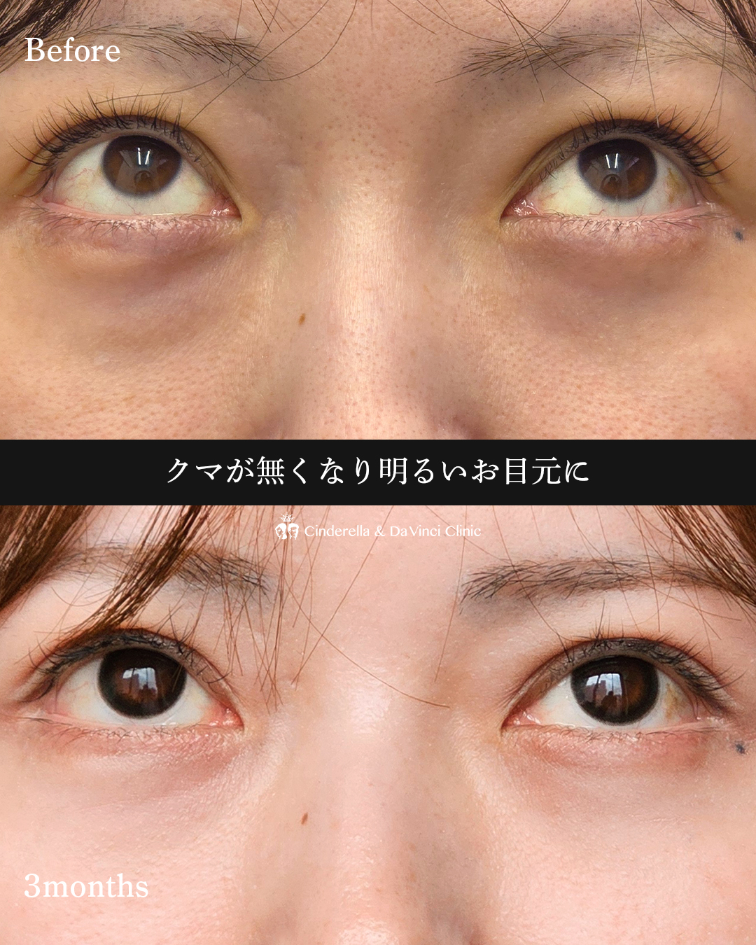 クマとさようならの画像