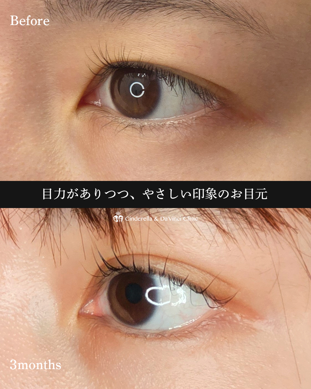 目を大きくするの画像