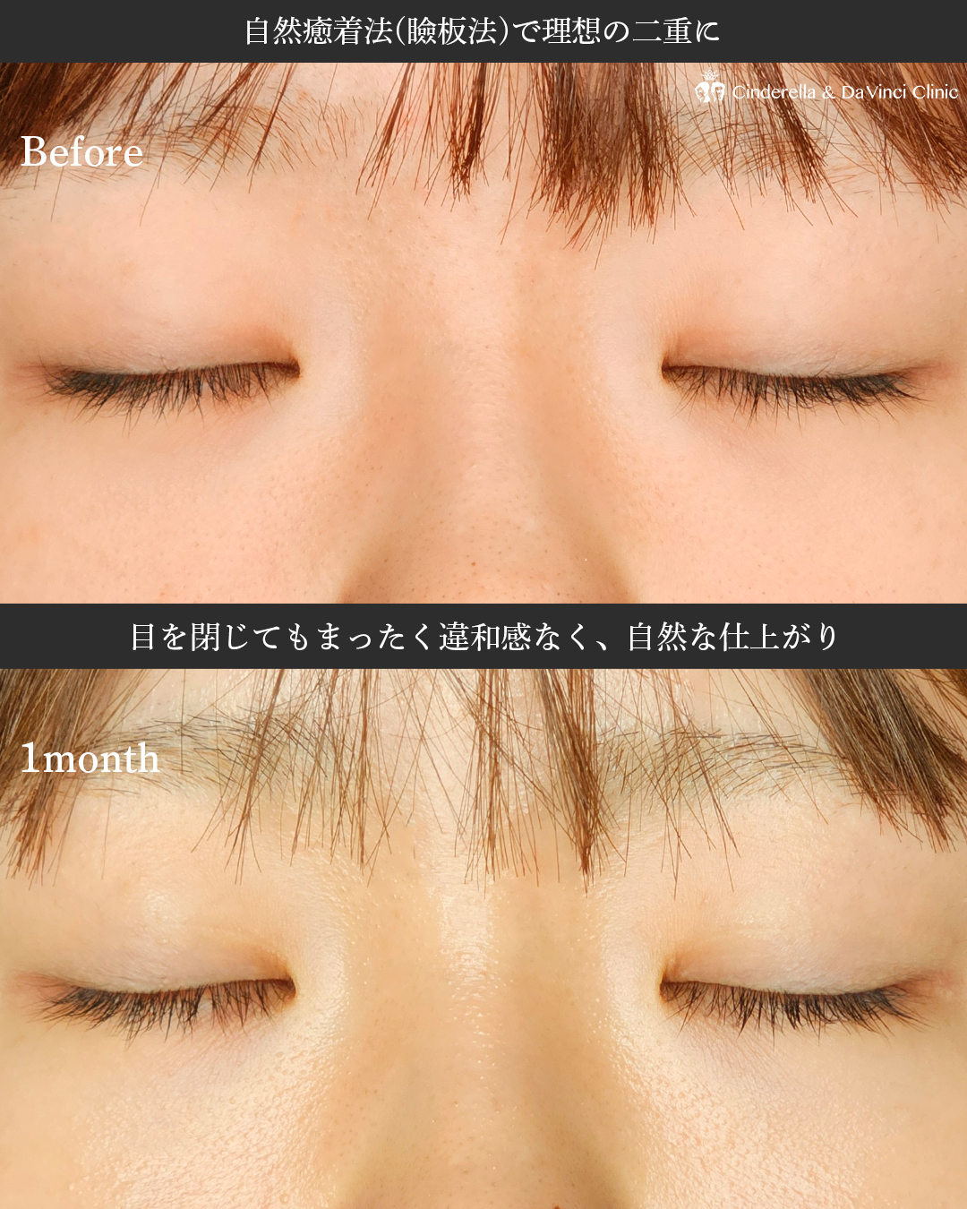 理想の二重の画像
